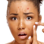 Does Pre Workout Cause Acne? The 2024 Guide You Must Know